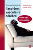 Phénoménologie de l'accident vasculaire cérébral : pourquoi un AVC ce jour-là et dans ces circonstances