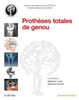 Prothèses totales du genou